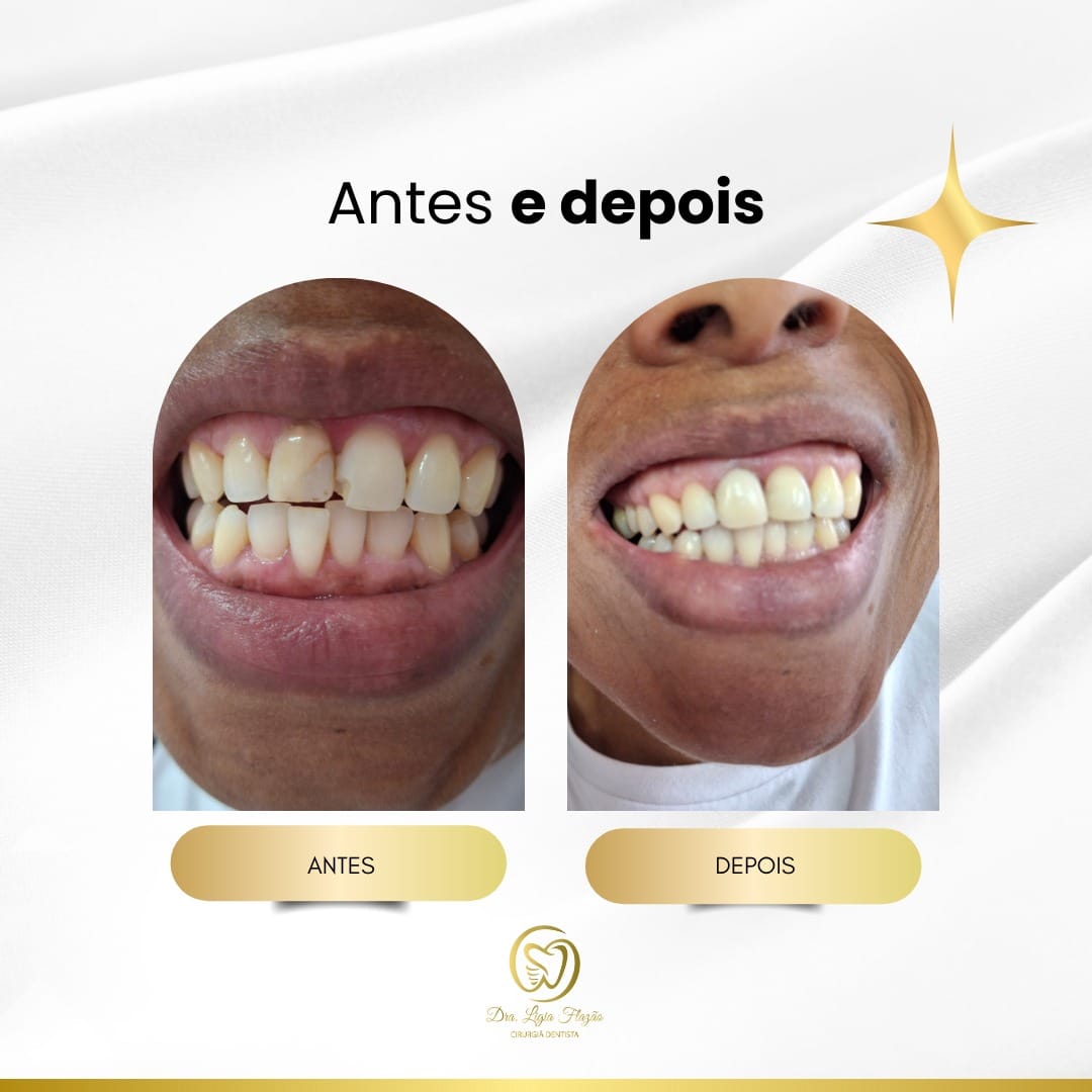 Resultado 4